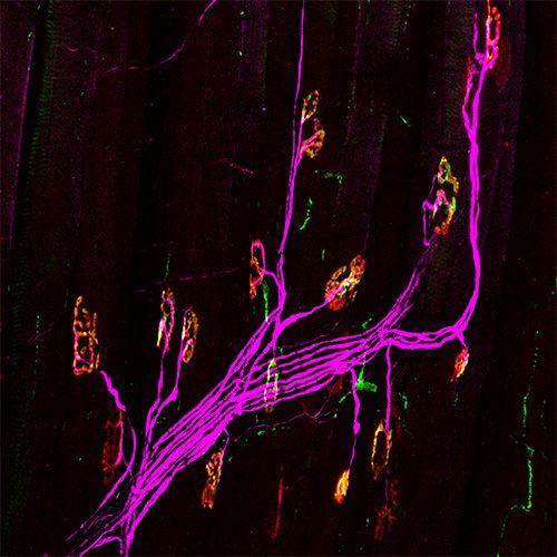 Neuromuscular junctions and motor neurons in a mouse with Pompe disease